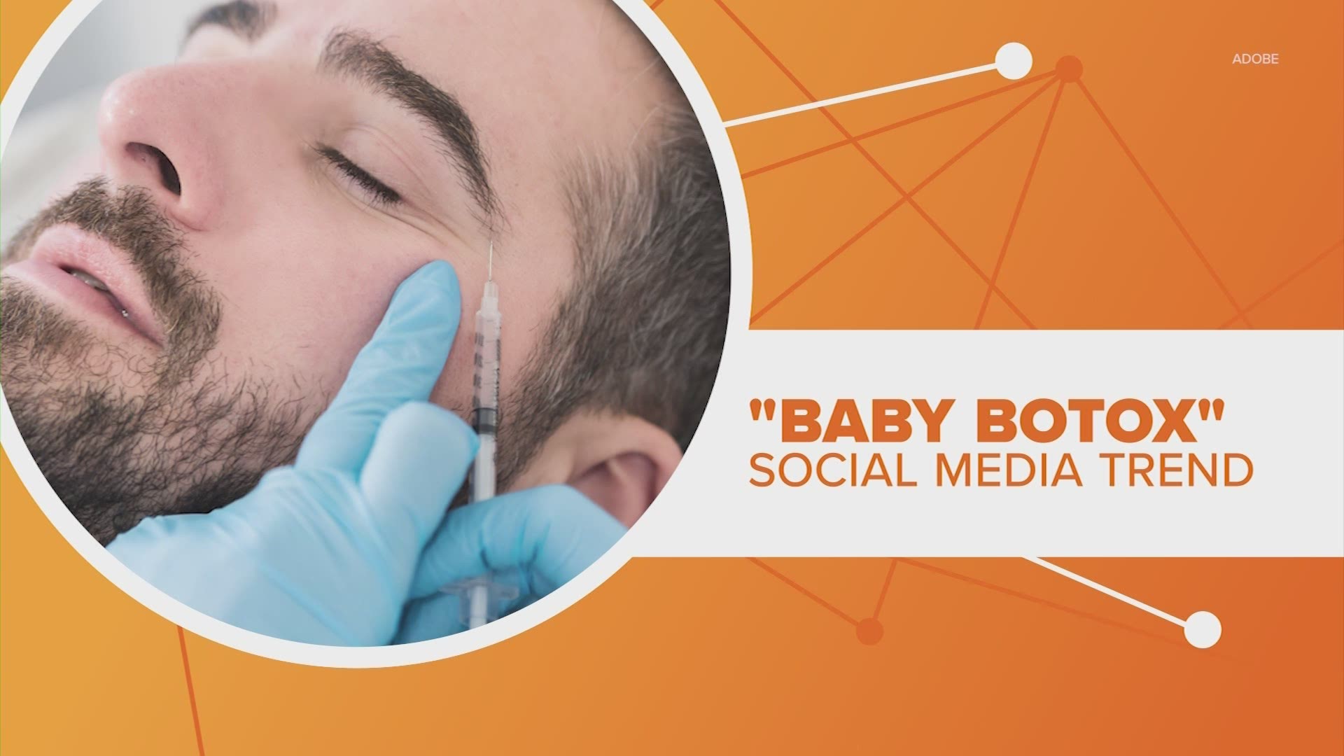 #HTownRush Connects the Dots on what doctors want people to know about the trend being called "Baby Botox"