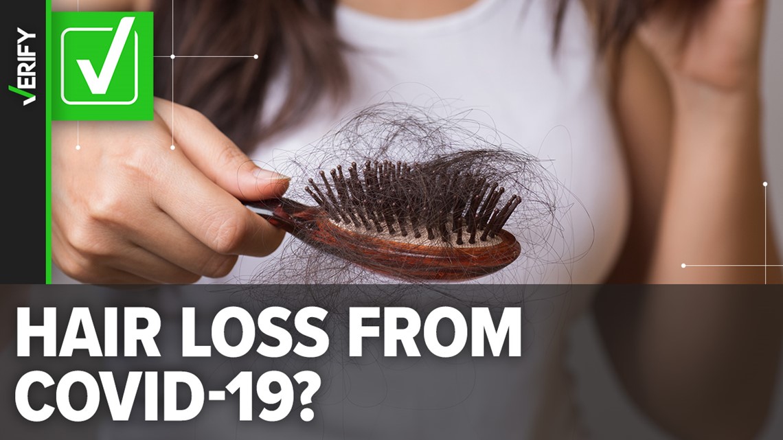Temporary hair loss can be caused by COVID-19