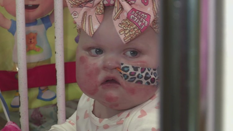 Baby Chloe is waiting for a heart this Valentine's Day; how you can help