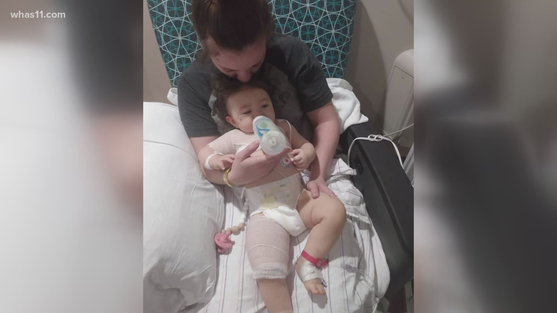 A 10-month-old girl is recovering in the hospital after being hit by a car in her own home.