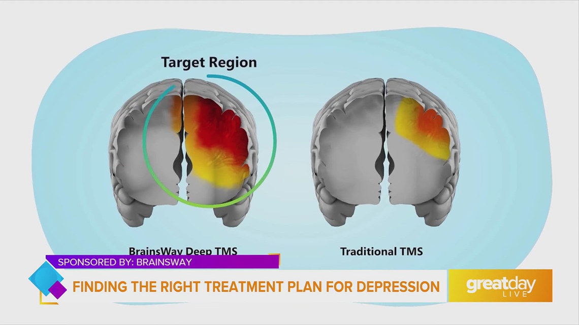 Discover the Best Treatment Plan for Your Depression with Brainsway ...