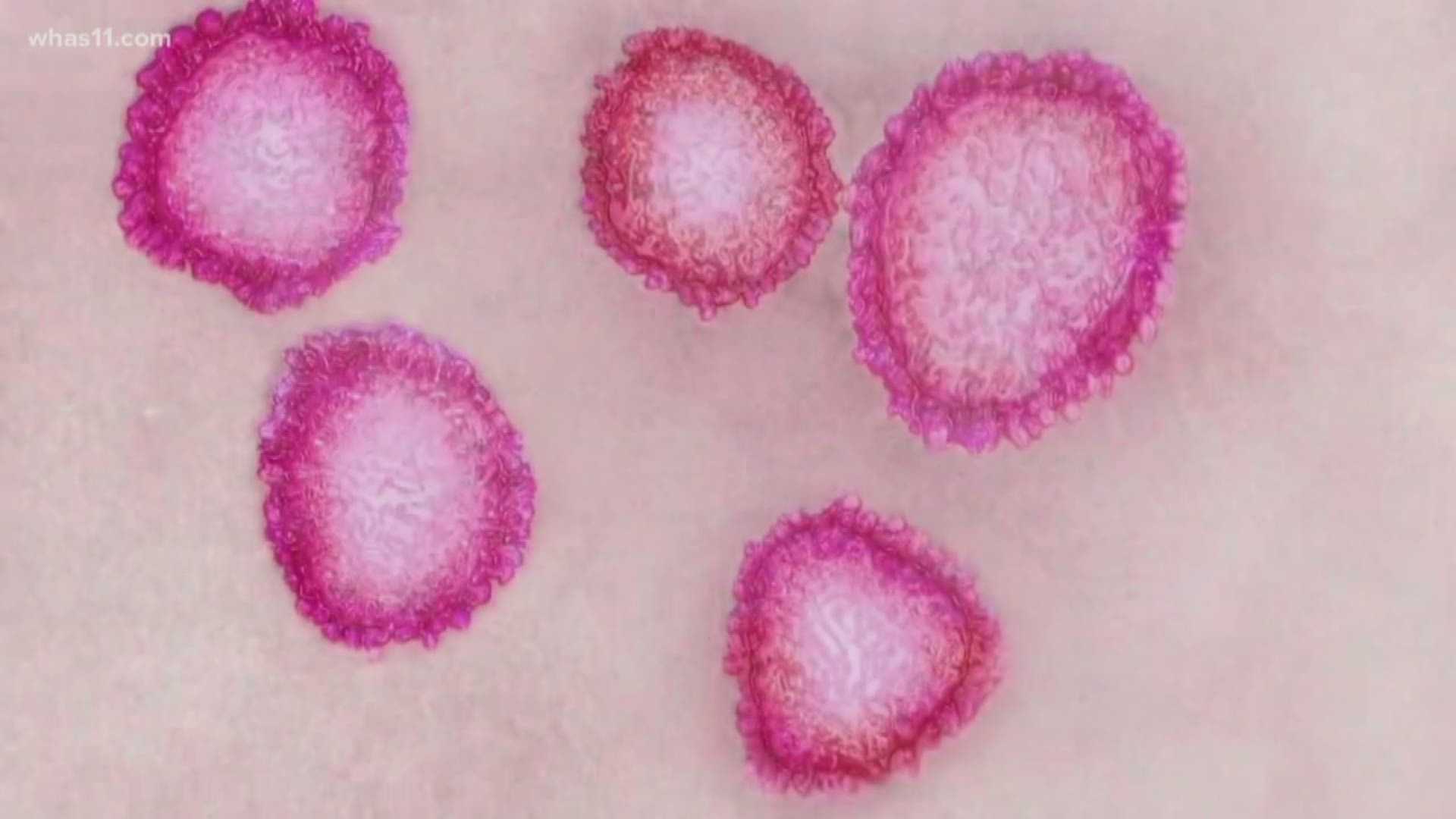 There are no confirmed cases in Indiana, but at least 30 people are being tested for the virus right now.