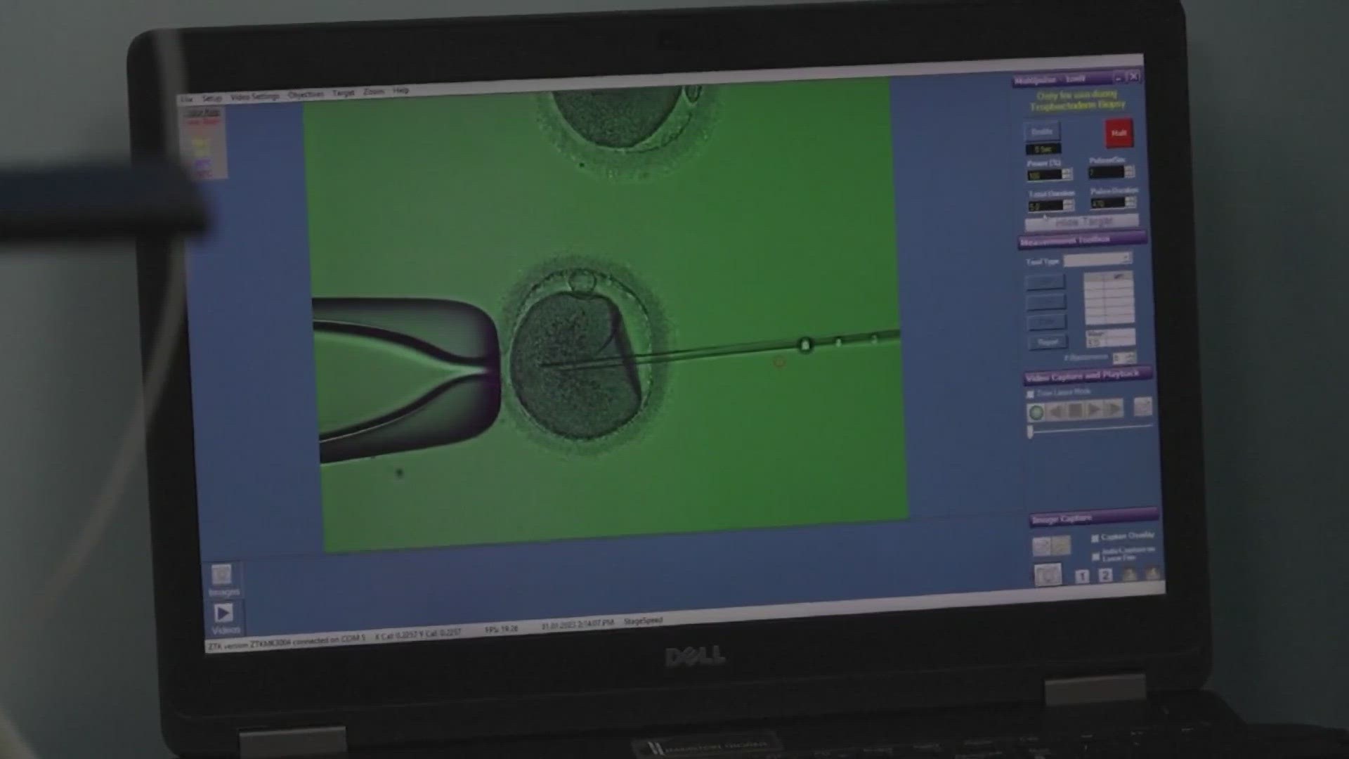 Republicans in the state Legislature proposed the lawsuit immunity as a way to get IVF clinics reopened.