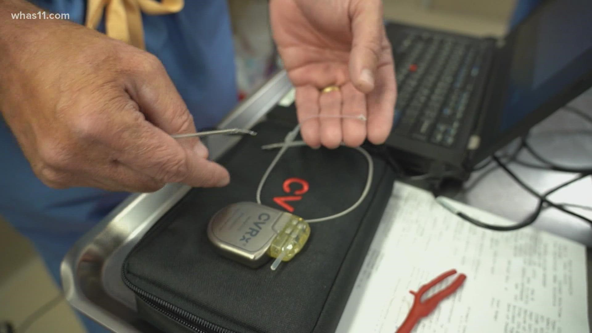 UofL Health is now the first in Kentucky to put in a device Barostim Neo that can help heart failure patients who don't respond to medications and therapies.