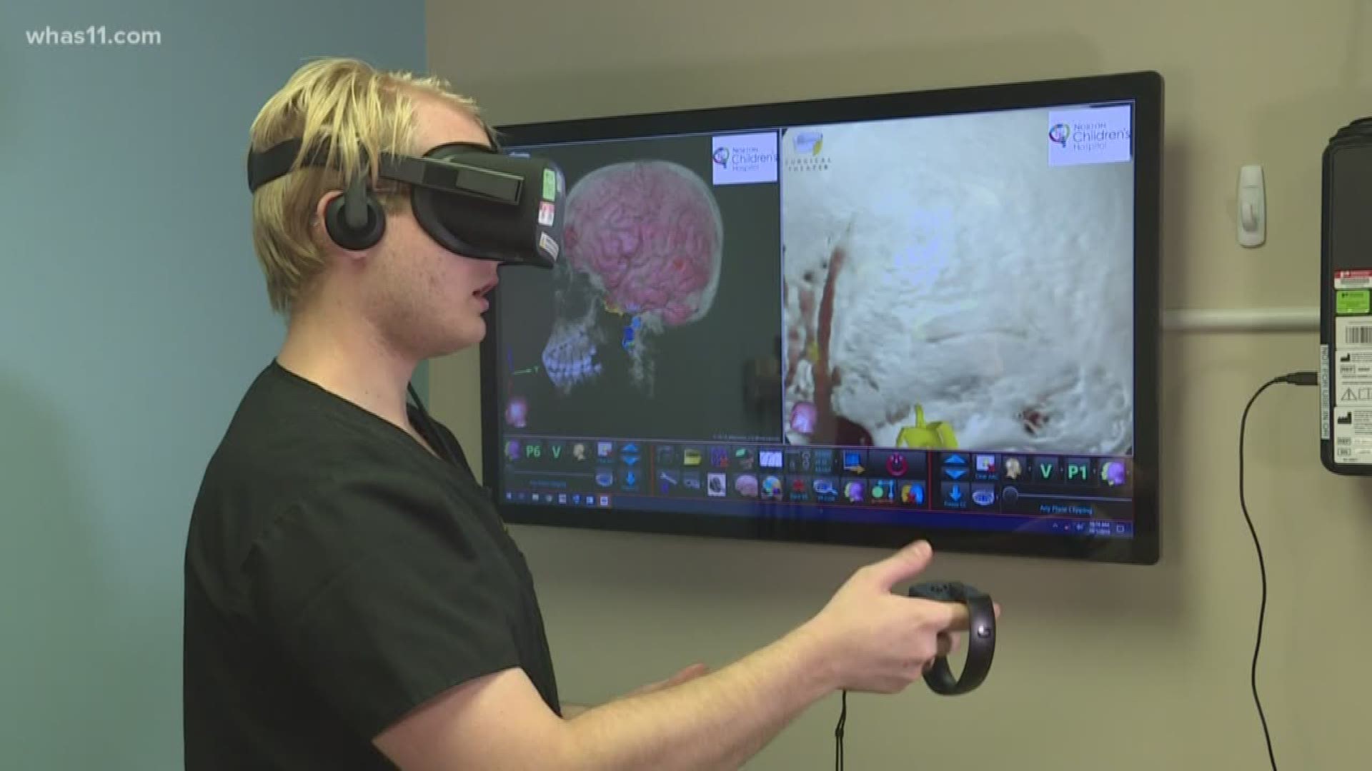 Neurosurgeons at Norton Children's Hospital utilizing virtual reality to prepare to conduct brain surgeries in more effective manner.