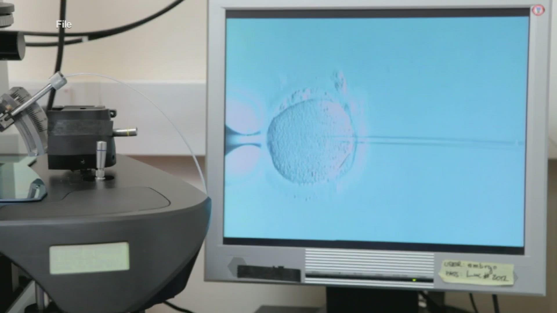 KY Gov. Andy Beshear Shows Support For IVF Treatment | Whas11.com