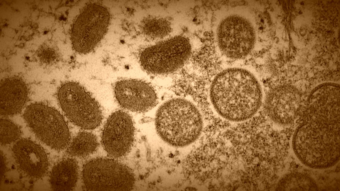 CDC warns of surge in 'Mpox' infections