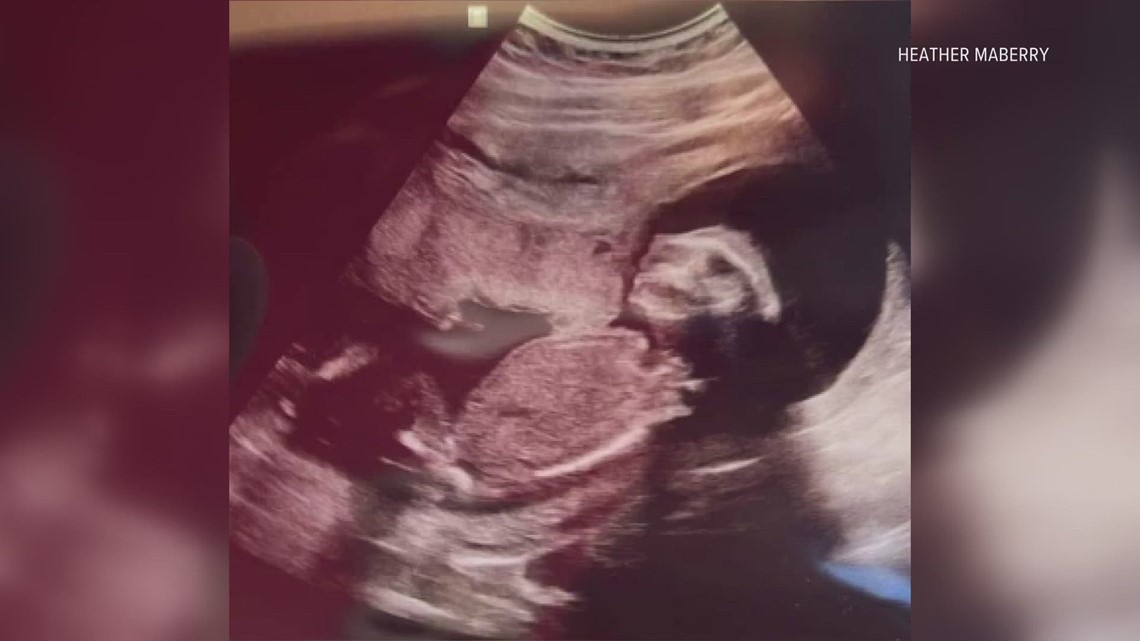 Kentucky woman forced to travel for abortion - Vimarsana News