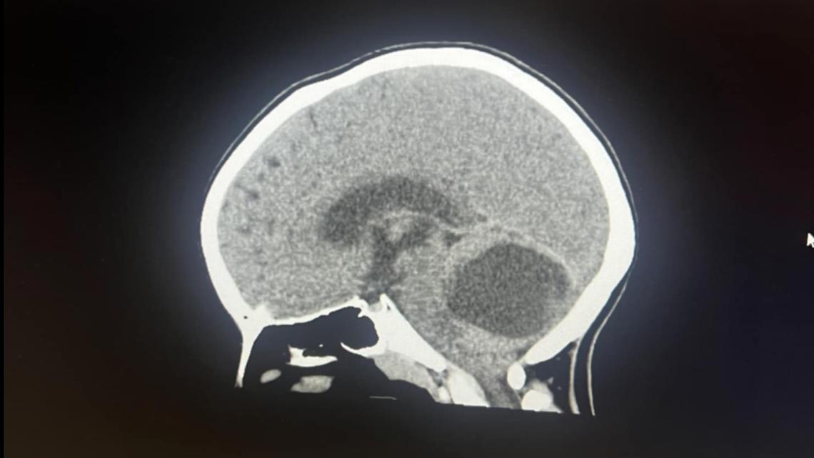 Ronomy Indiana parents push for more opinions before child diagnosed with ...