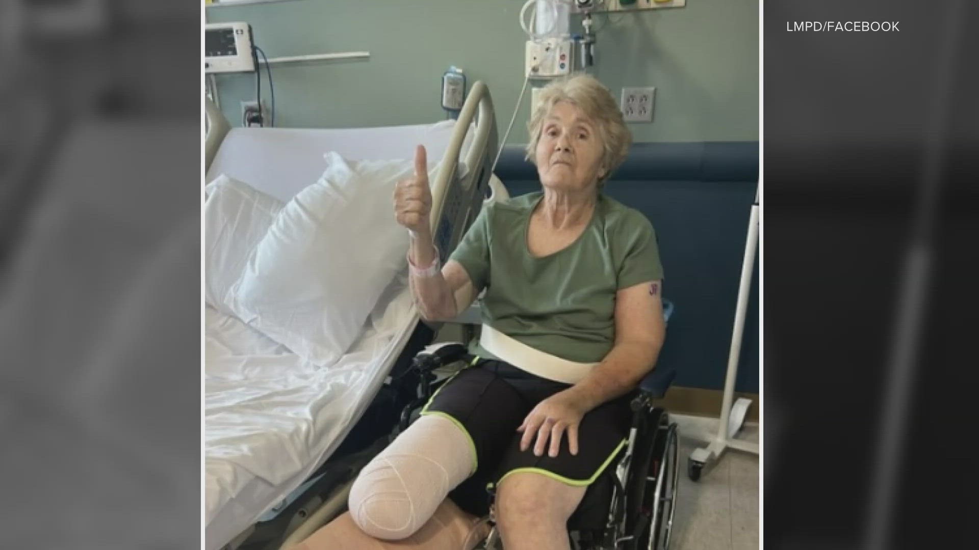 Gertrude Schaftlein had one leg partially amputated as a result of the hit-and-run.