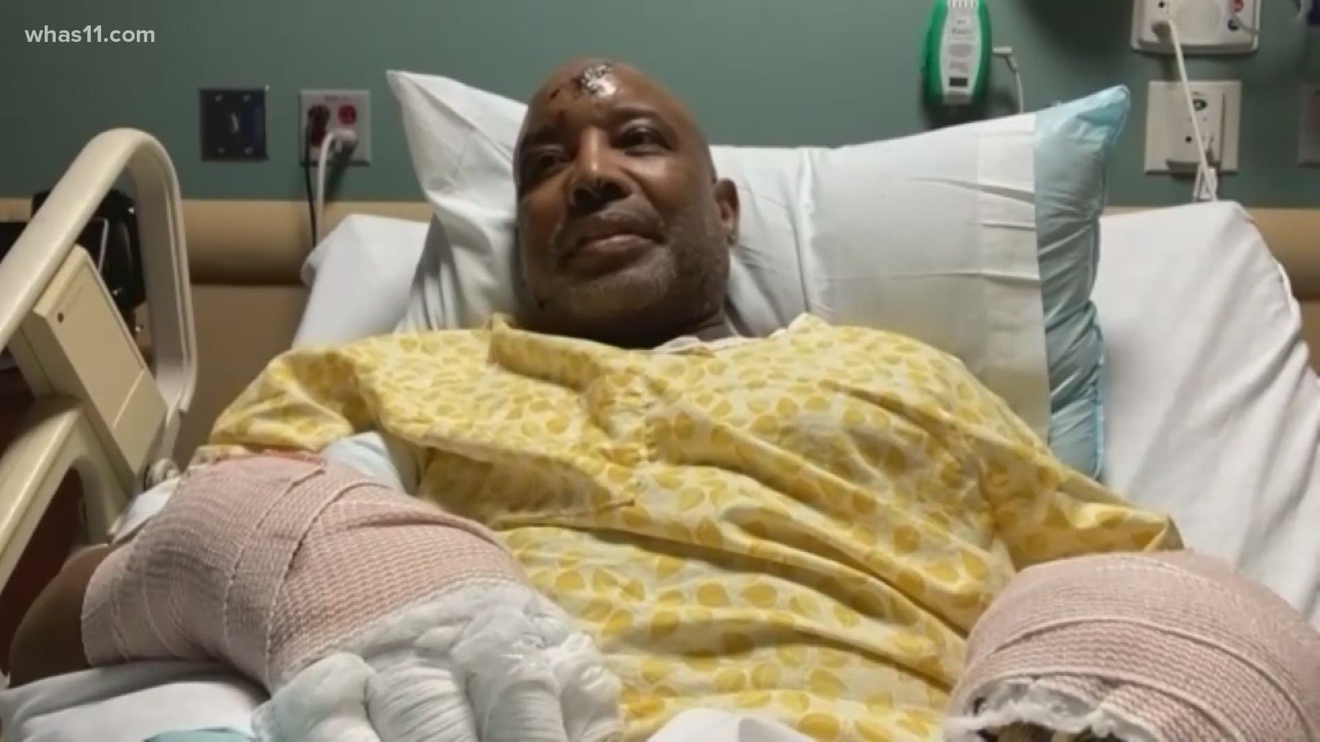 It's almost been a month since David Weaver was attacked by three pit bulls walking through Shawnee Park. Now, he's meeting the person who helped him.