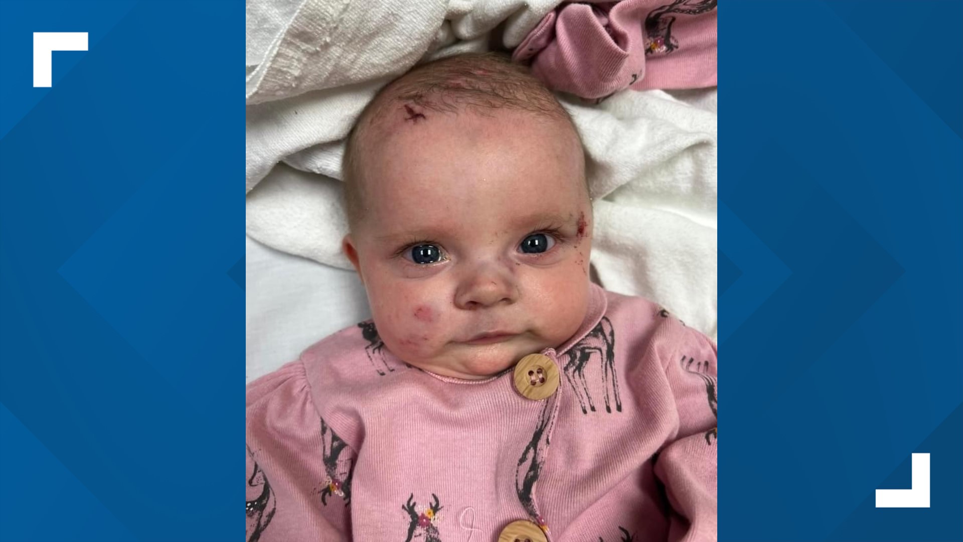 Baby Oaklynn was pulled off life support after swelling to her brain worsened, her father said.