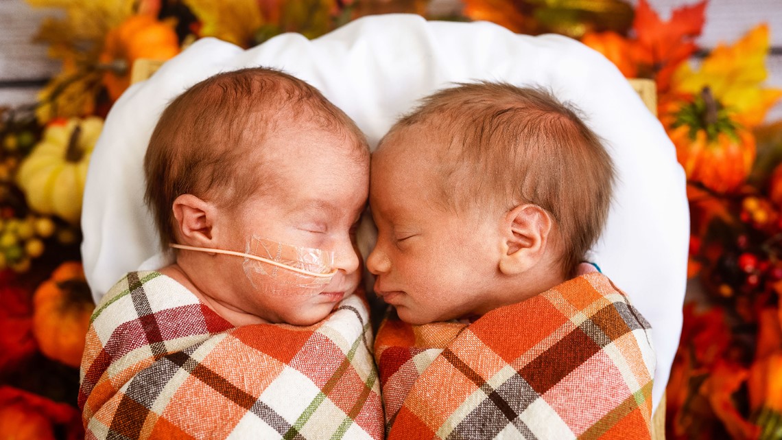 UofL Hospital NICU Babies Pose In Their Holiday Best, Louisville KY