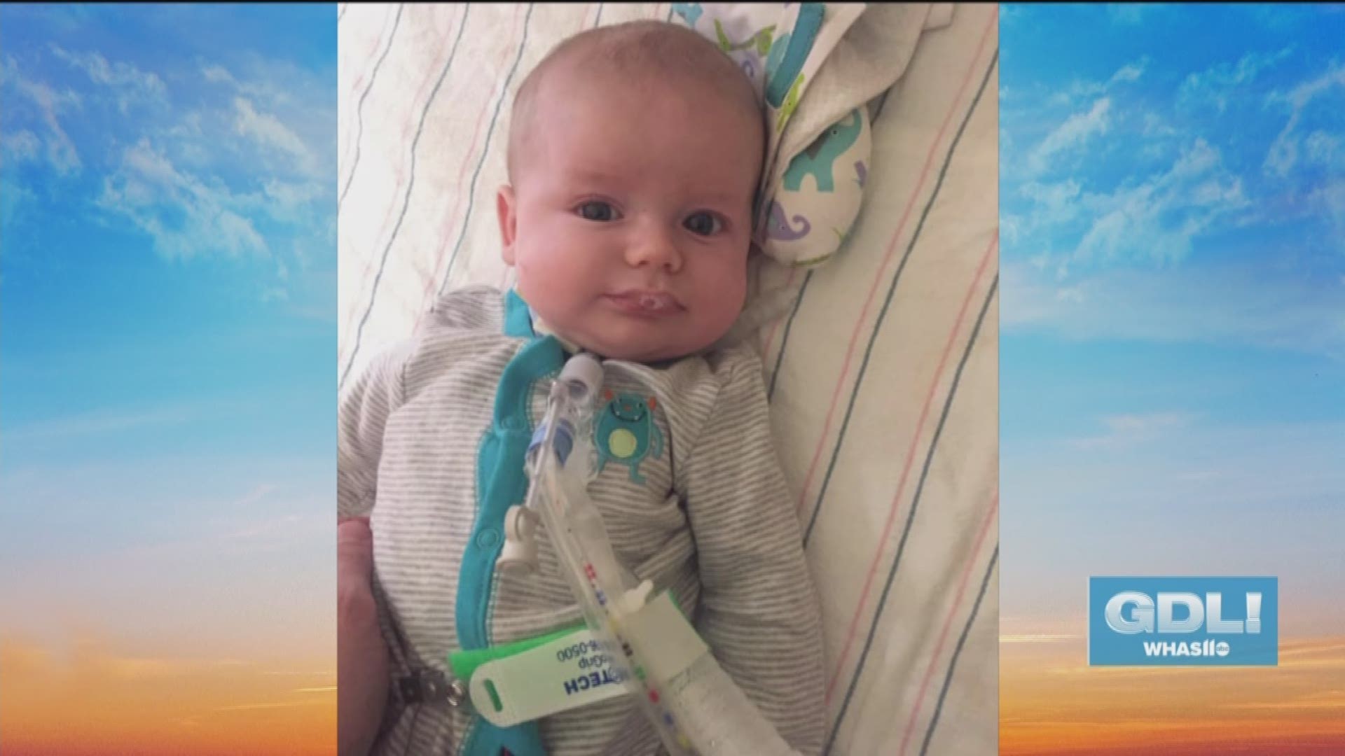 The Howell family is working to raise awareness about a rare condition called SMARD, which their infant son was diagnosed with. The #SmashSMARD Challenge invites people to take a pie to the face in order to raise money and awareness.