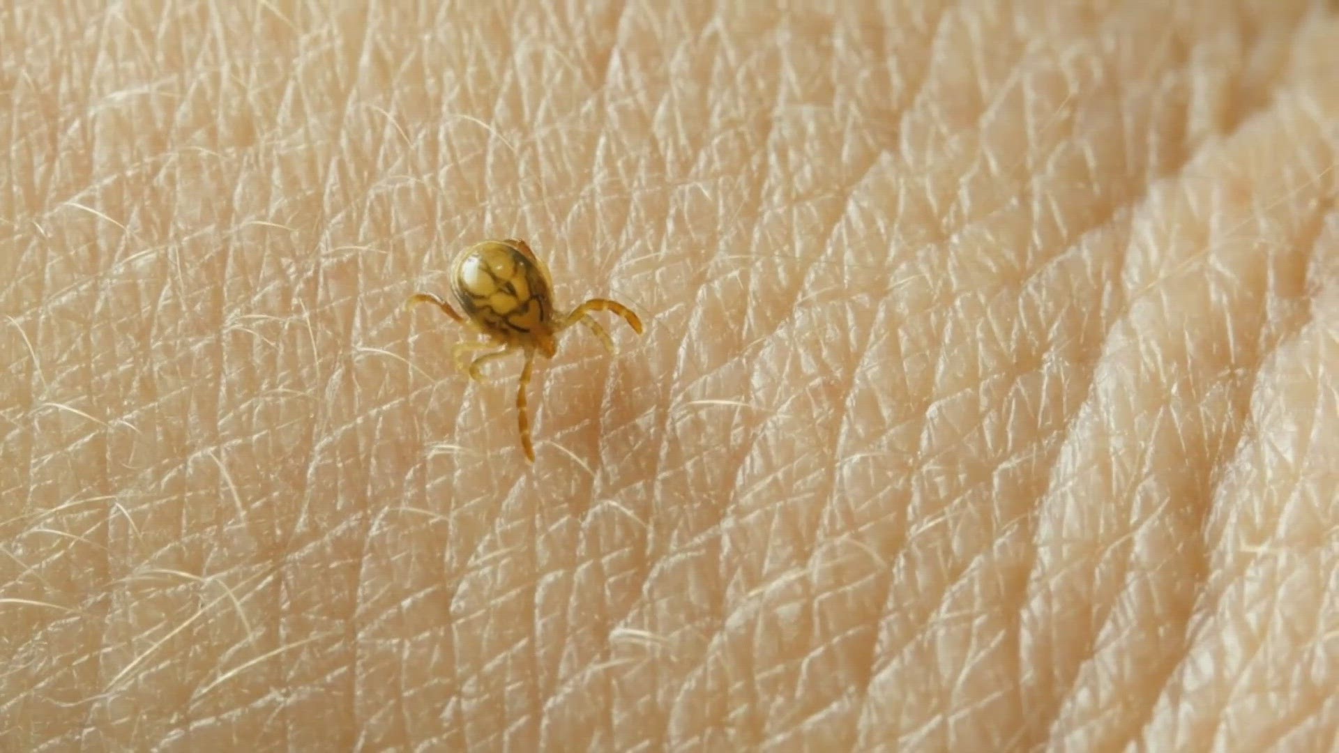 Tips and tricks to fight pesky ticks this summer