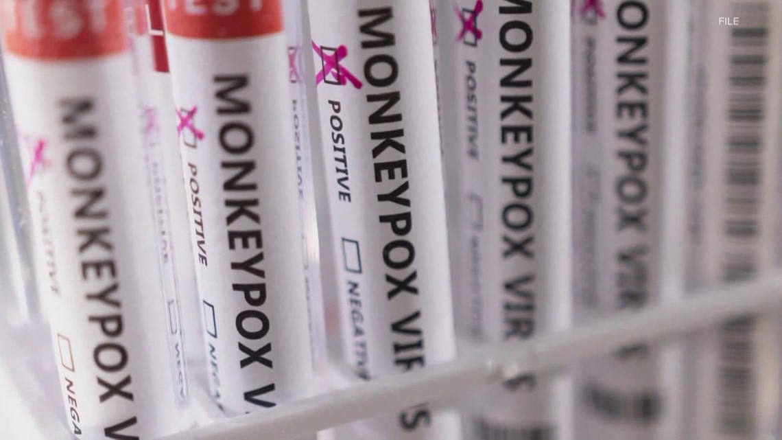 Suspected Monkeypox patient says it's difficult getting diagnosis - Vimarsana News