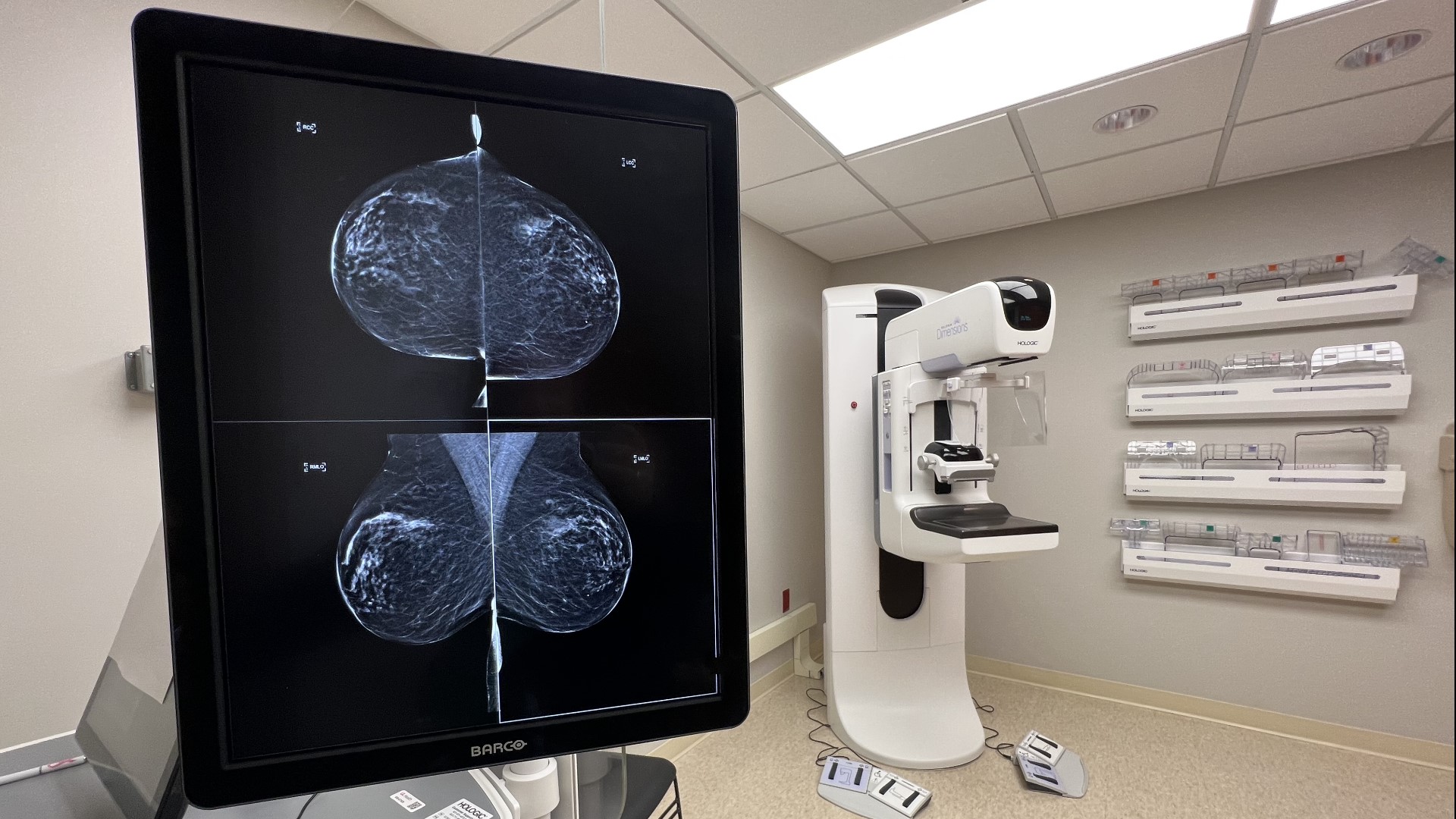 Uofl Health Expands Access To Breast Cancer Screenings