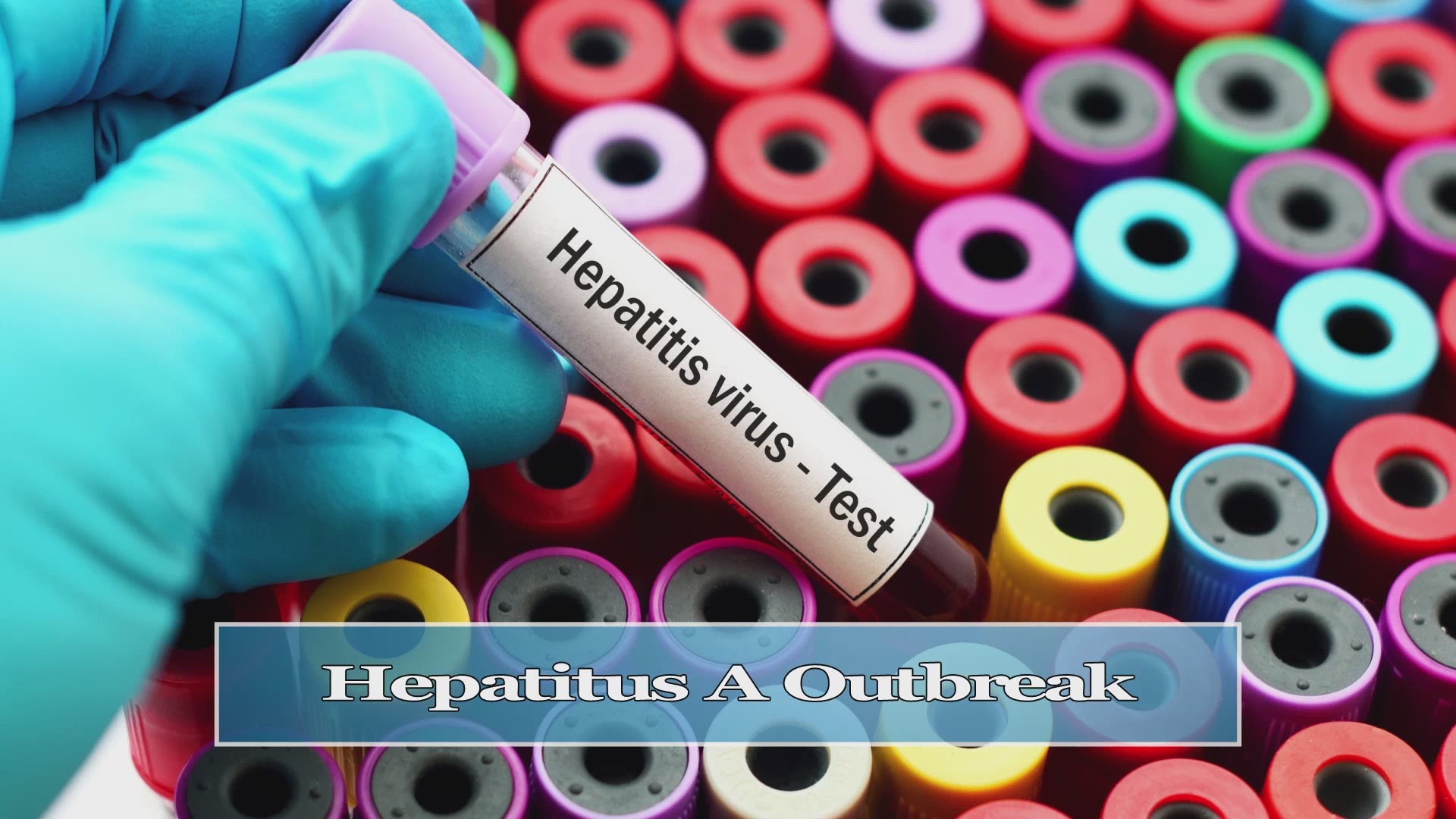 Dr. Ryan Stanton talks about an outbreak that's going on throughout Kentucky especially in Louisville but in other cities as well, and that's hepatitis A.