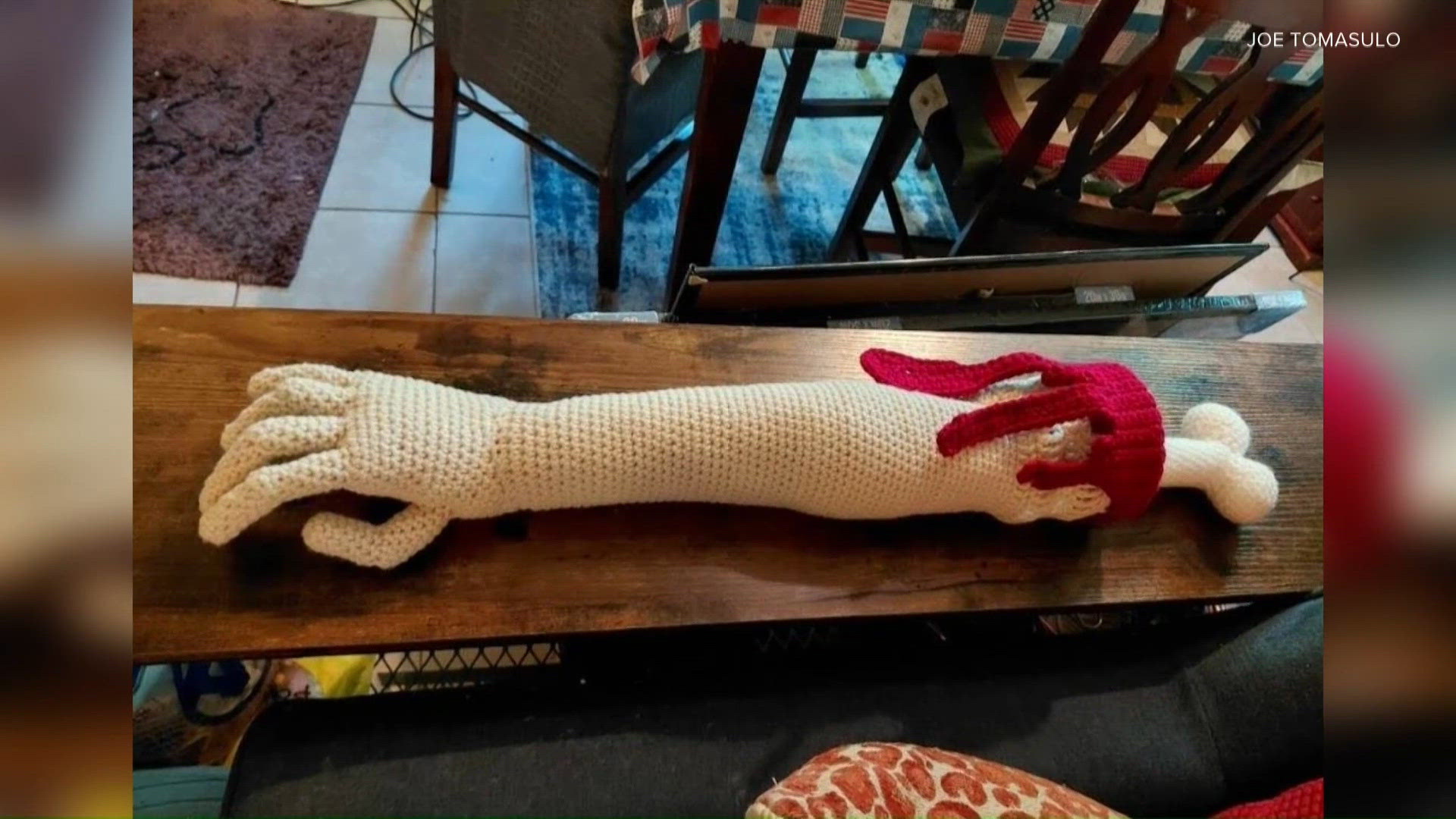 Kentucky man goes viral after receiving crochet arm | whas11.com