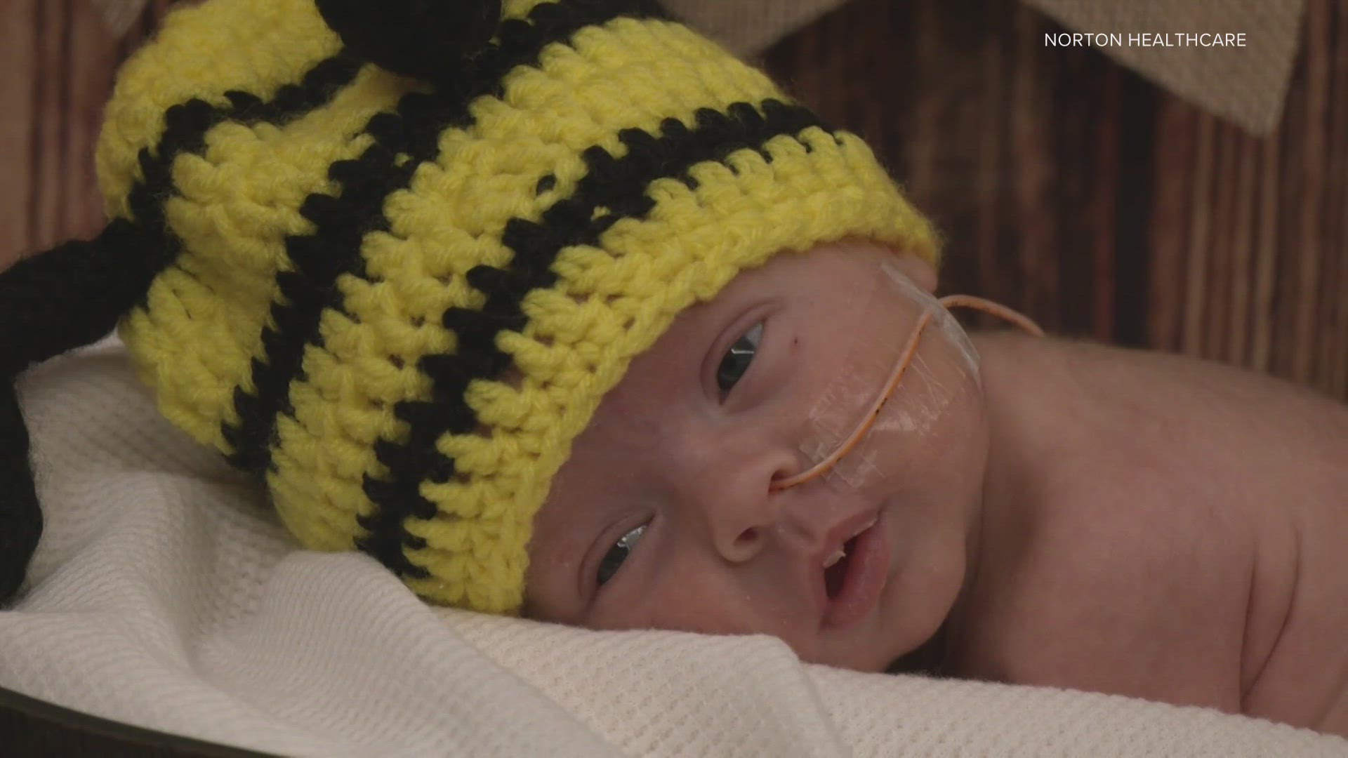 The NICU at Norton Women's and Children's Hospital celebrated their newborns with a cute Halloween photoshoot.