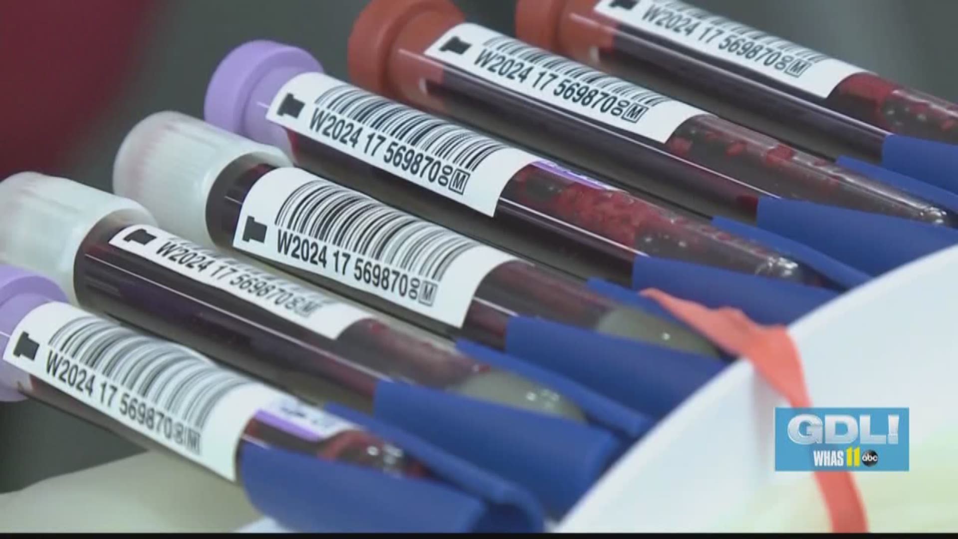 UofL researchers aim to extend shelf life of blood