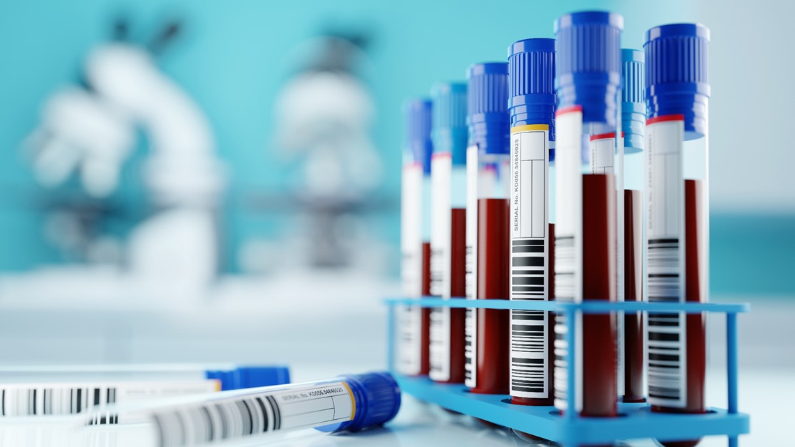 USF awarded $3.2M for creation of Alzheimer's disease blood tests - Vimarsana News