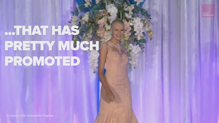 Pageant queen competes bald to bring awareness to hair-pulling disorder, trichotillomania