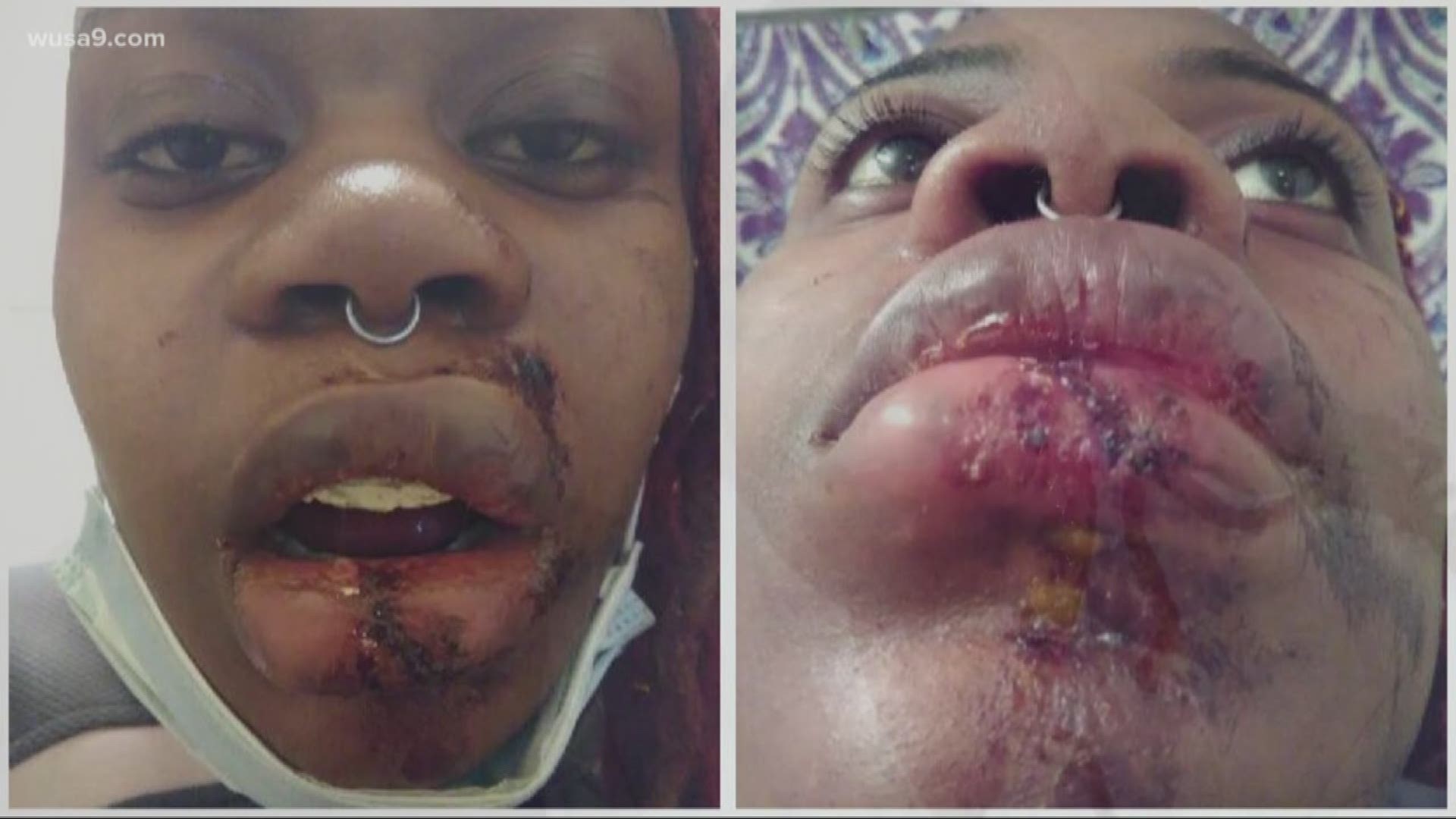 A DC woman says Metro Transit police took things too far with her.